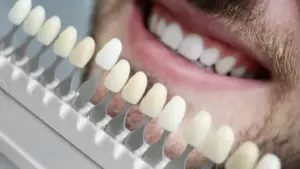 Diş Kaplama Nasıl Yapılır?