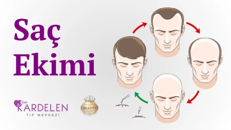 Saç Ekimi