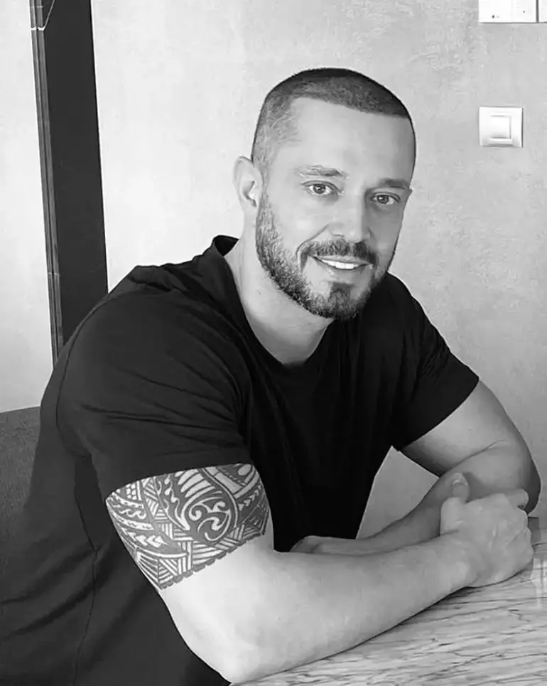 Murat Boz Saç Ekimi 1