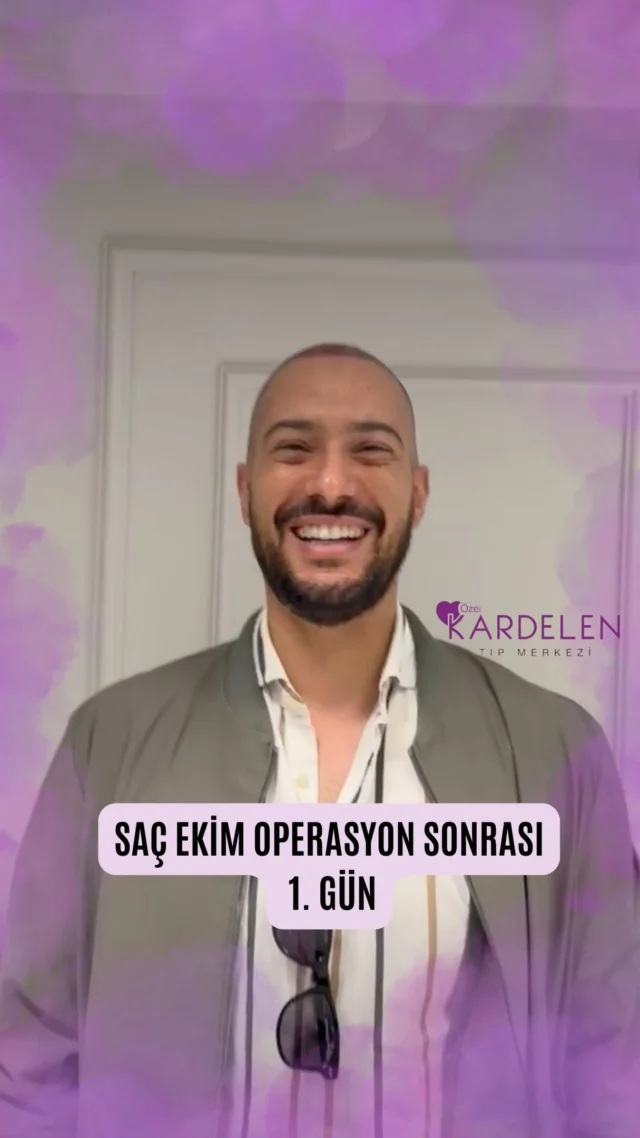 Özel Kardelen tıp merkezinde 
4700 greft 
Yüksek yoğunluk 
Saç Ekim Operasyon sonrası 1. Gün
-

Safir FUE Saç Ekim Operasyonu
💬 DM
☎️ +90 553 768 43 46

Her cerrahi veya girişimsel işlemde sonuçlar kişiden kişiye değişiklik gösterebilir. İşlem öncesinde hekiminizden detaylı görüş almanız önerilir.

Özel Kardelen Tıp Merkezi, uluslararası sağlık turizmi kapsamında yetkili sağlık kuruluşudur.

-
#tıpmerkezi #saçekim #saçekimi #saçekimoperasyonu #saçekimsonuçları