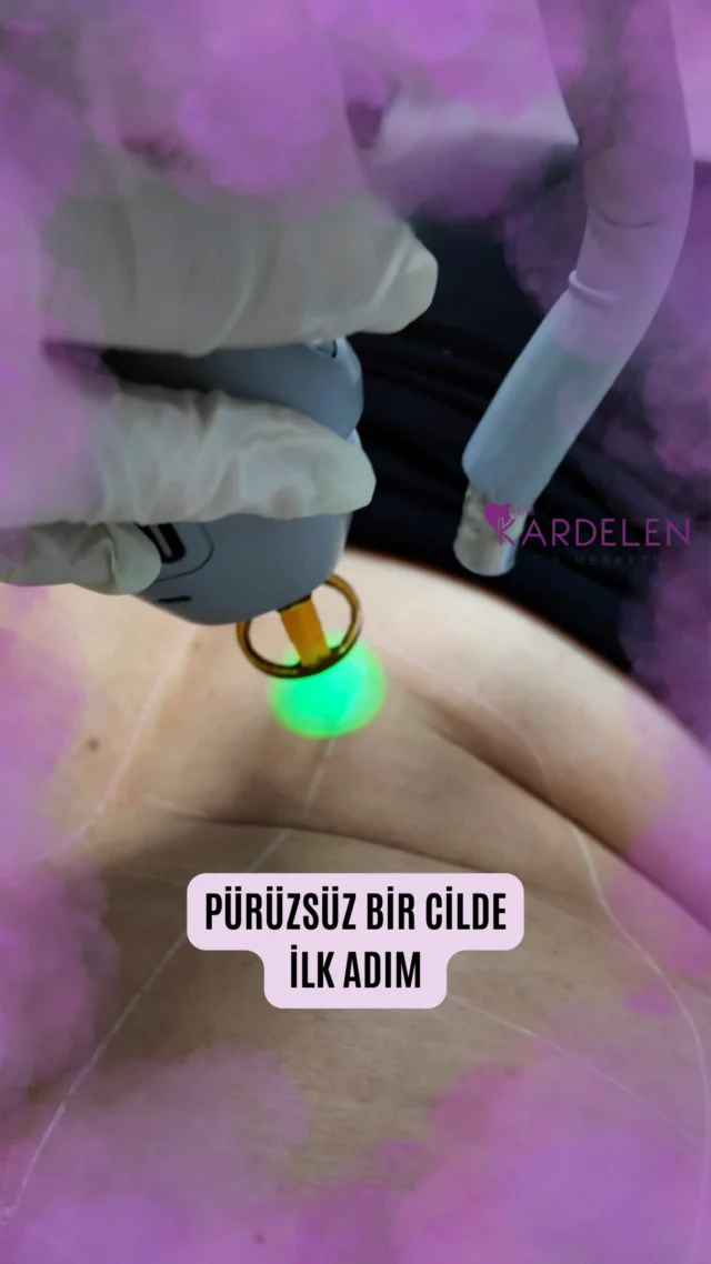 Lazer epilasyon, istenmeyen tüylerin azaltılmasına yönelik uygulanan yöntemlerden biridir. Uygulama öncesinde kişinin cilt ve kıl yapısı değerlendirilerek uygun planlama yapılır.
Lazer epilasyon hakkında detaylı bilgi almak için sağlık profesyonellerimizle iletişime geçebilirsiniz.
📍 Özel Kardelen Tıp Merkezi
#ÖzelKardelenTıpMerkezi #LazerEpilasyon #lazer #SağlıkBilgilendirme